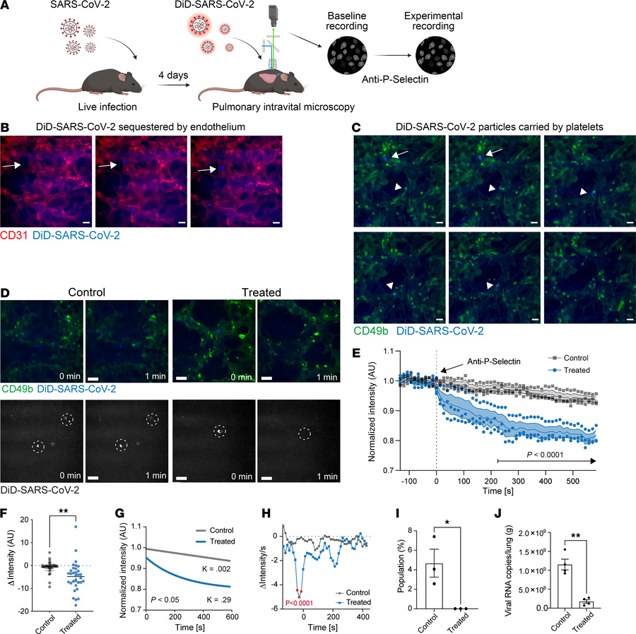 Authentic SARS-CoV-2 uses P selectin to bind to the endothelium in lung ...