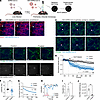 Authentic SARS-CoV-2 uses P selectin to bind to the endothelium in lung cap