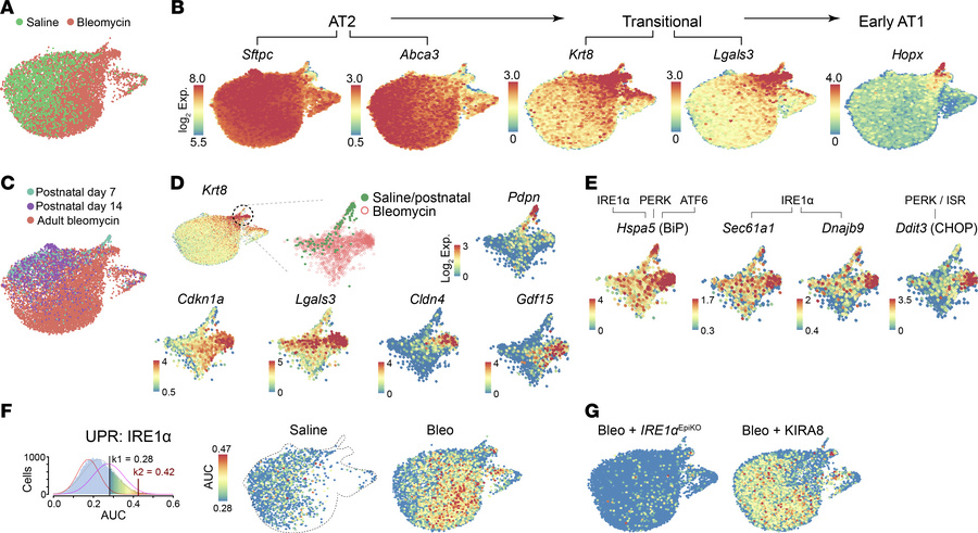 An IRE1α-active subpopulation of fibrotic DATPs emerges after bleomycin ...