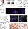 Inhibition of RIDD with PAIR2 protects mice from fibrosis.