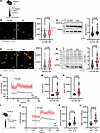 Hyperglycemia and tunicamycin (an ER stress inducer) increase platelet SEC6
