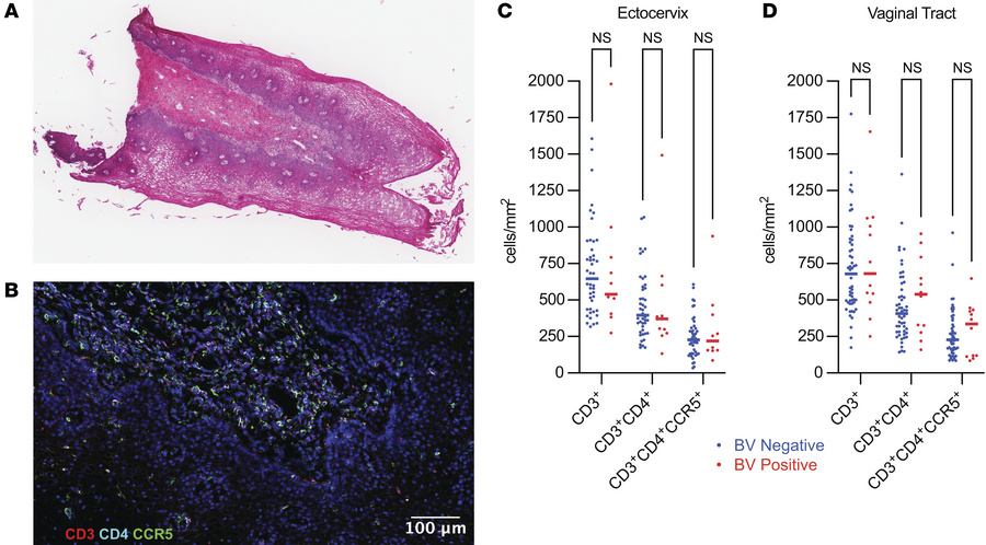 The total density of T cells and HIV target cells in the cervix and vagi...