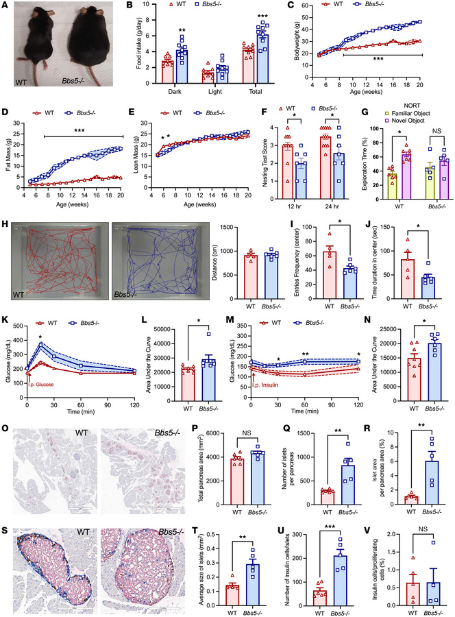 Adult Bbs5-null mice are morbidly obese, hyperphagic, glucose intolerant...