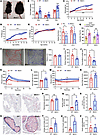 Adult Bbs5-null mice are morbidly obese, hyperphagic, glucose intolerant, a