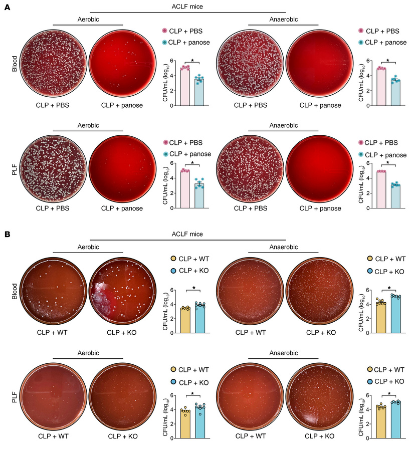 Panose combats bacterial infection in ACLF mice.
(A and B) Representativ...