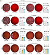 Panose combats bacterial infection in ACLF mice.