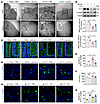 Panose combats bacterial infection in ACLF mice by restoring the intestinal