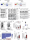 UBE2N dependency is predominant in immunoproteasome-positive AML.