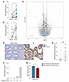 Propionate supplementation increases local histamine levels in patients wit