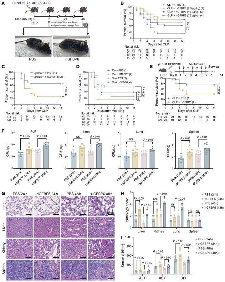 IGFBP6 promotes the occurrence and progression of sepsis.
(A) The study ...
