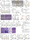 IGFBP6 inhibits the secretion of epithelial cell–derived CCL2.