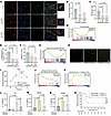 IGFBP6 impairs macrophage-mediated bacterial phagocytosis and killing.