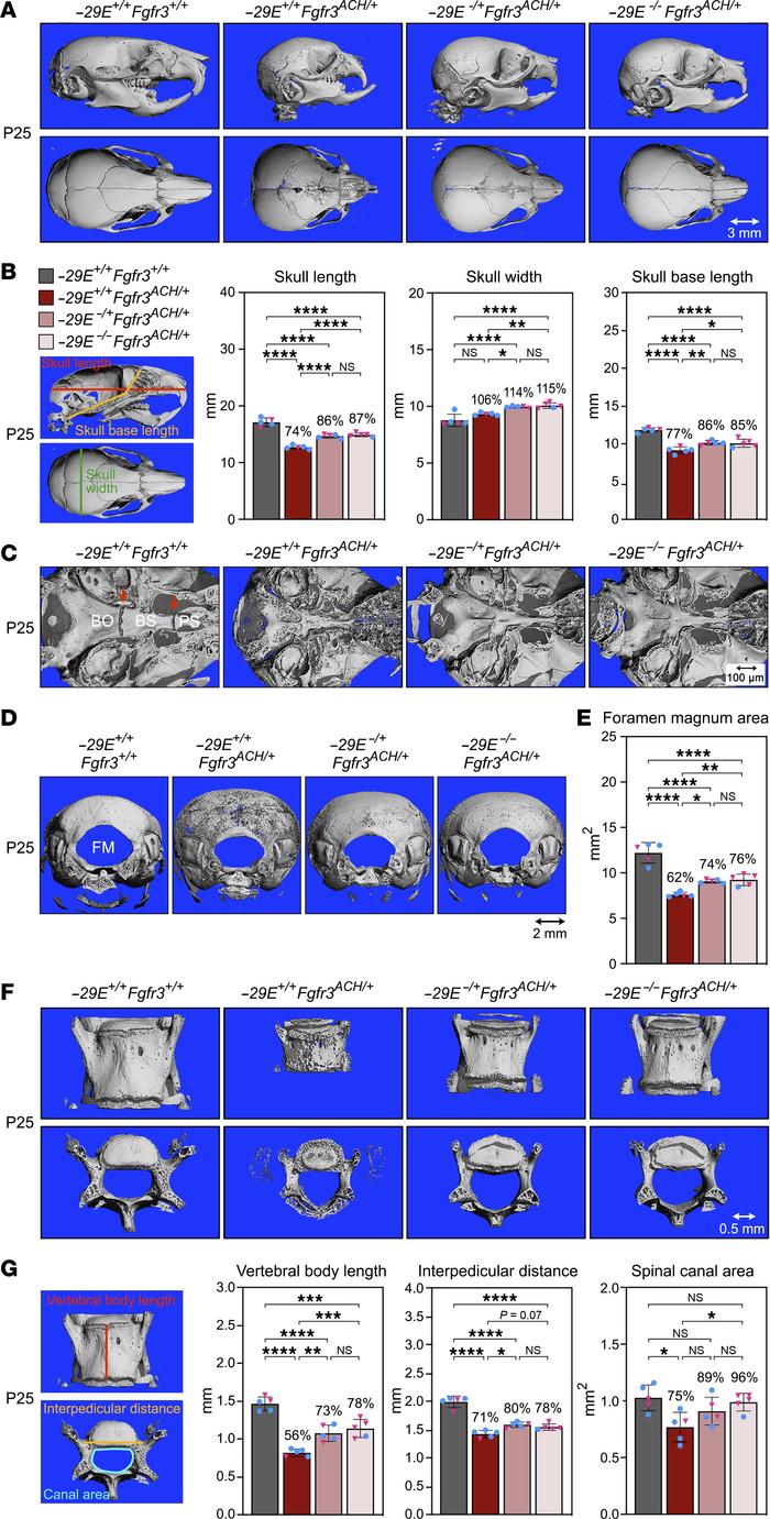 
–29E deletion lessens skull and vertebral malformations of achondroplas...