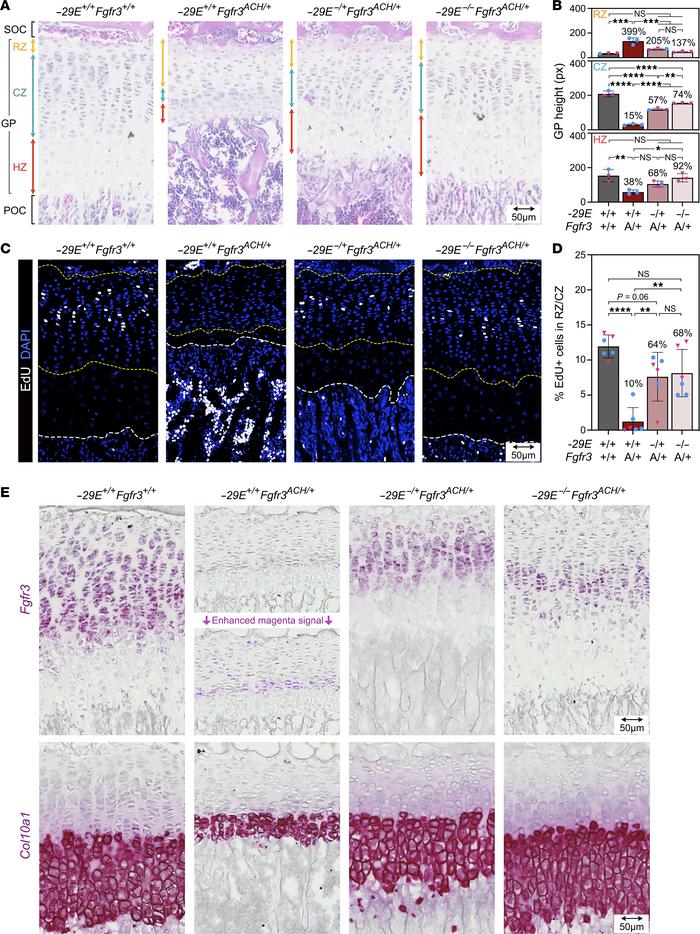 
–29E deletion lessens GP defects in achondroplastic mice.
(A) Pictures ...