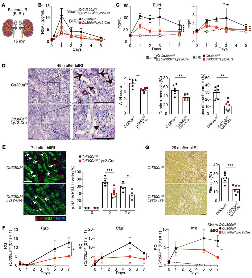 CD300a deficiency ameliorates AKI and fibrosis after biIRI.
(A) Bilatera...