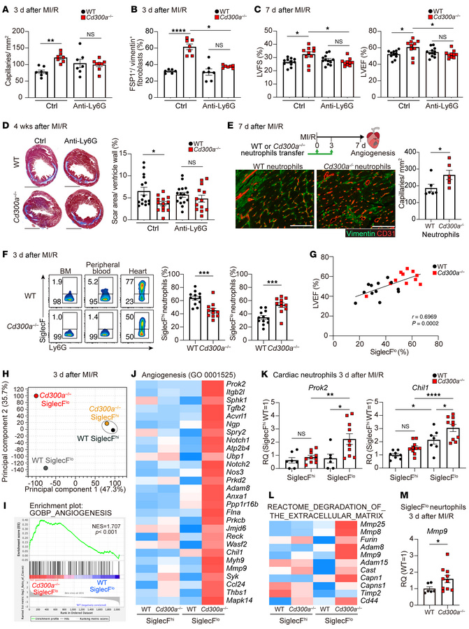 CD300a deficiency upregulates pro-angiogenic and antifibrotic genes in S...