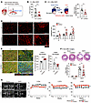 CD300a deletion ameliorates myocardial ischemia and reperfusion injury and