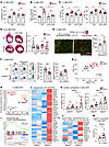 CD300a deficiency upregulates pro-angiogenic and antifibrotic genes in Sigl