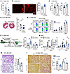 Anti-CD300a mAb ameliorates tissue injury and adverse remodeling.