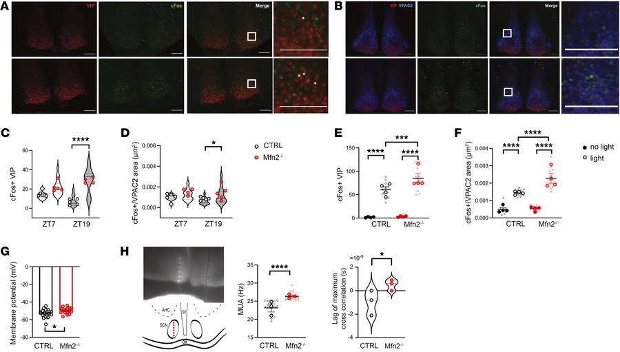 Loss of Mfn2 in VIP neurons alters the synchronization of SCN neuronal a...