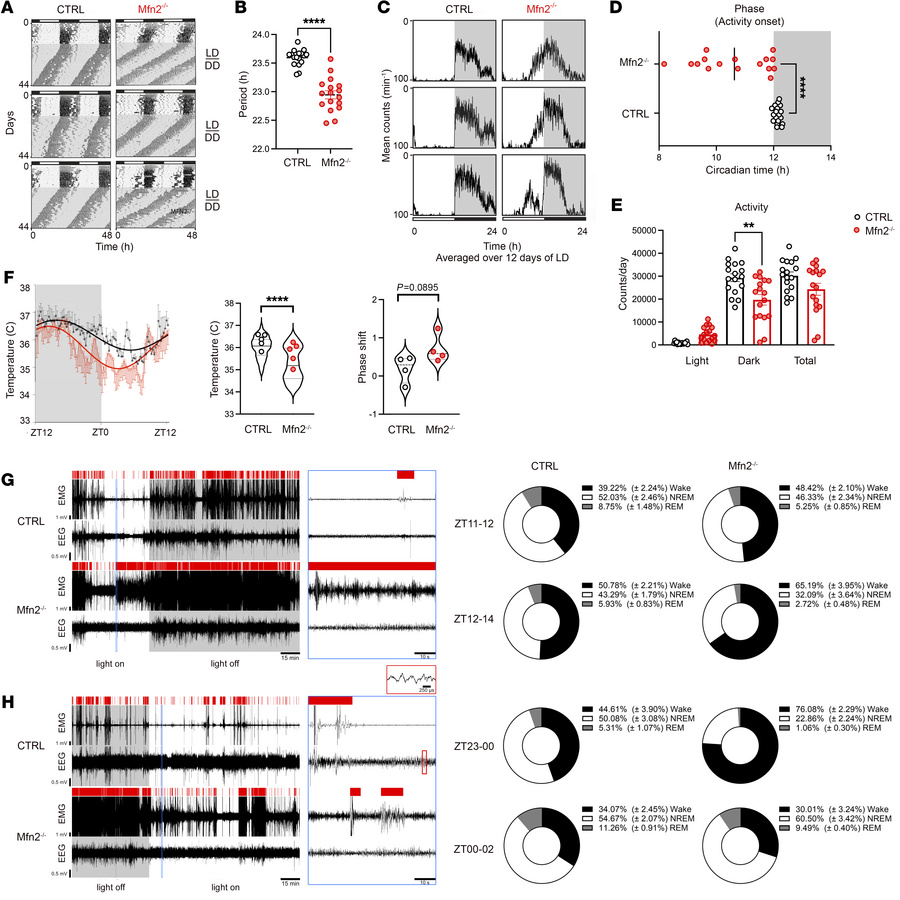 Loss of Mfn2 in VIP neurons alters the diurnal activity rhythm and activ...