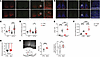 Loss of Mfn2 in VIP neurons alters the synchronization of SCN neuronal acti