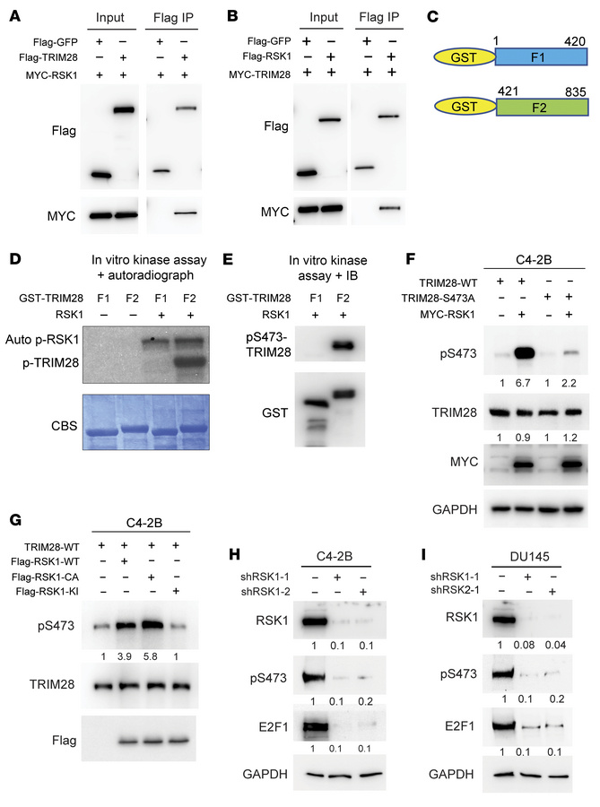 RSK1 directly phosphorylates TRIM28 at S473 in CRPC.
(A and B) RSK1 inte...