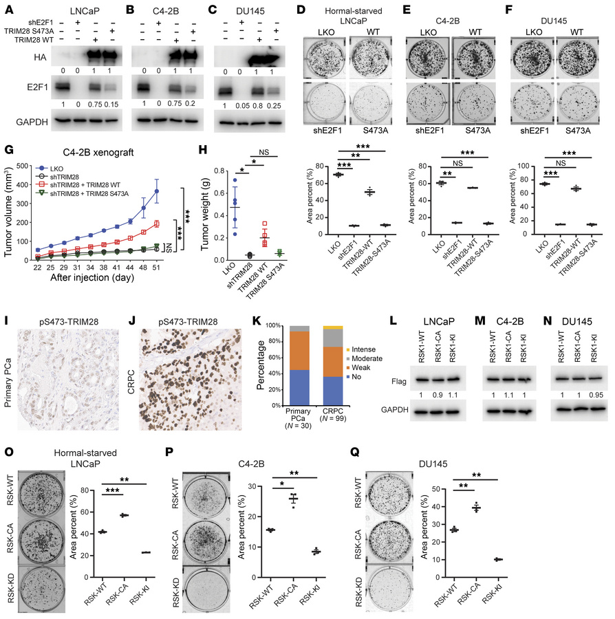 pS473-TRIM28 is required for CRPC progression.
(A–F) pS473-TRIM28 promot...