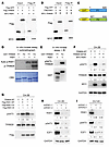 RSK1 directly phosphorylates TRIM28 at S473 in CRPC.