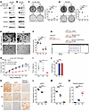 Exploitation of the RSK1-TRIM28–E2F1 axis as a vulnerability in Rb1-deficie