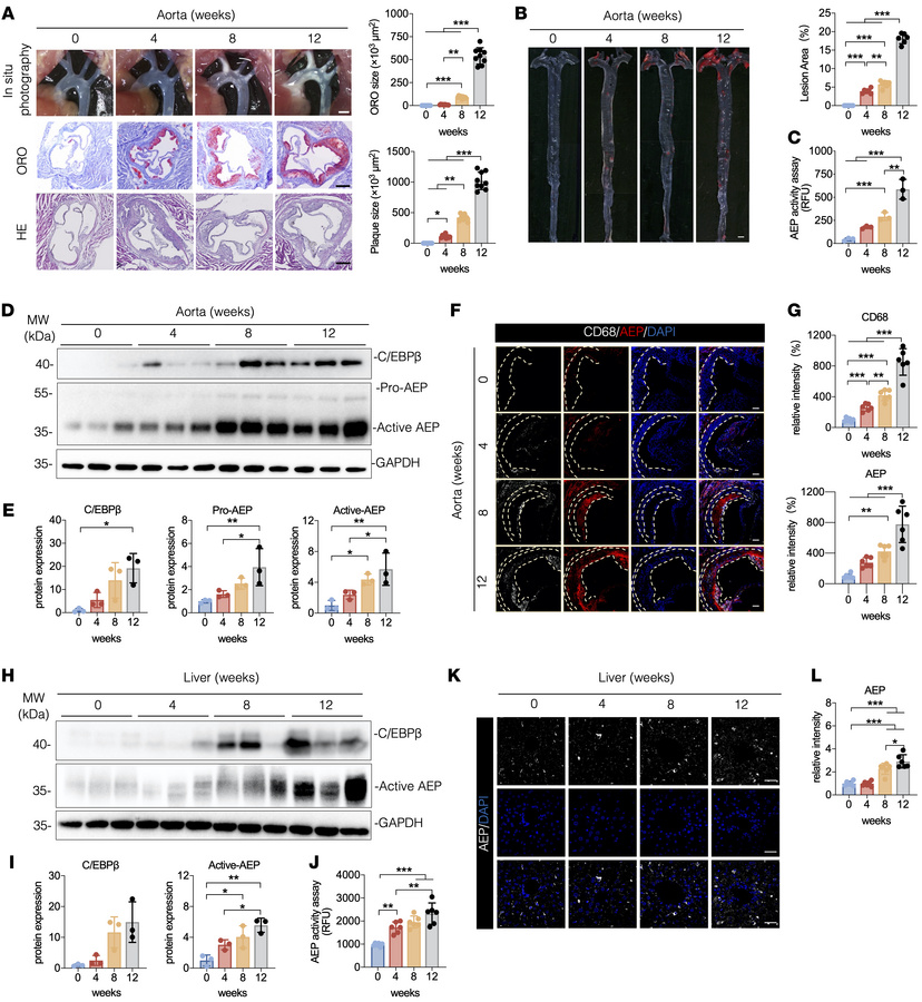Increased AEP activation in the liver and aorta of APOE–/– mice.
(A–L) A...