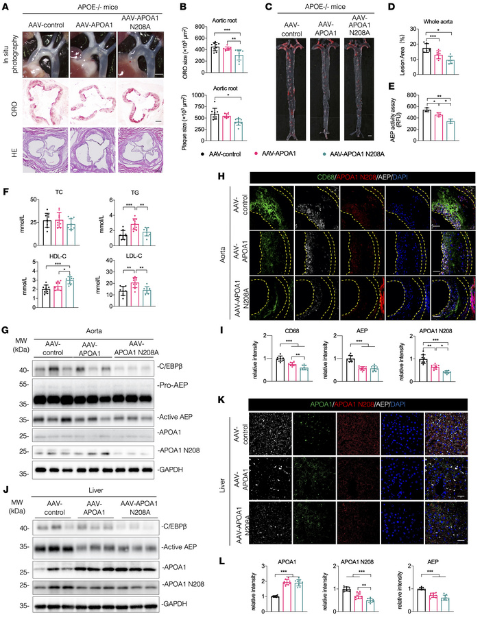 Blockade of APOA1 cleavage by AEP attenuates atherosclerosis in APOE–/– ...