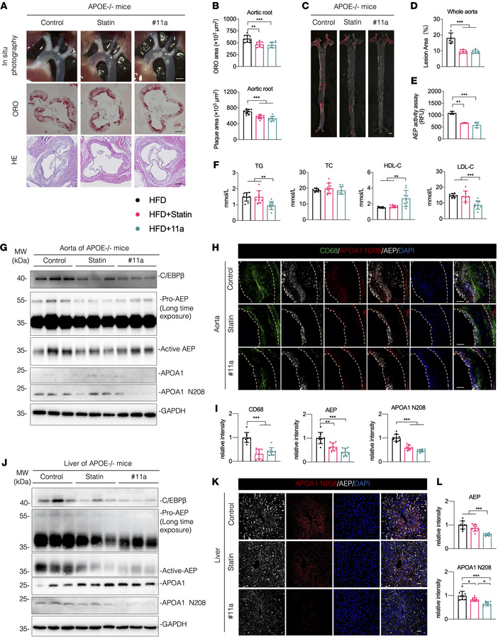 Inhibition of AEP with specific inhibitor #11a attenuates atherosclerosi...
