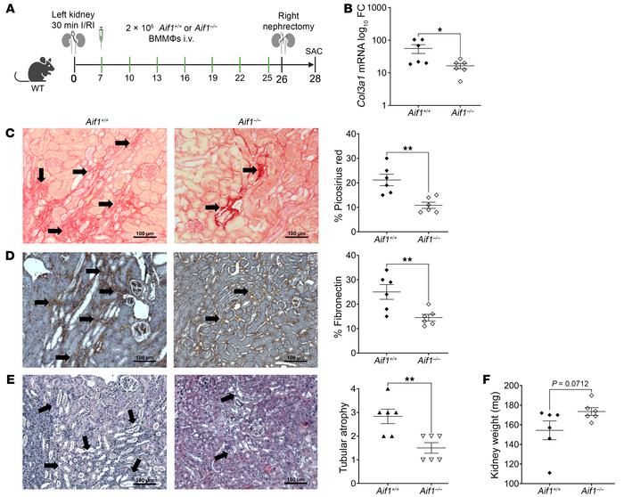 Adoptive transfer of Aif1–/– MΦs alleviates fibrosis following I/RI in W...