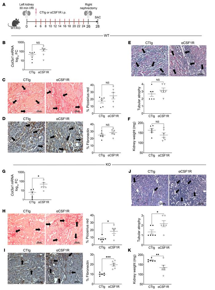 MΦ depletion in Aif1-KO mice worsens fibrosis and atrophy after I/RI.
(A...