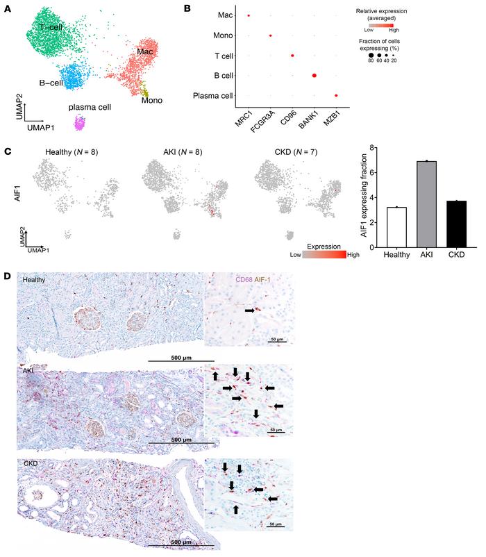 
Aif1 is expressed in human kidneys with AKI or CKD.
(A–C) snRNA-Seq of ...