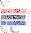 Aif1 KO attenuates kidney fibrosis and atrophy.