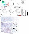 Aif1 is expressed in human kidneys with AKI or CKD.