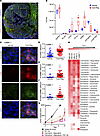 Upregulation of antigen presentation gene signature and T cell activation a