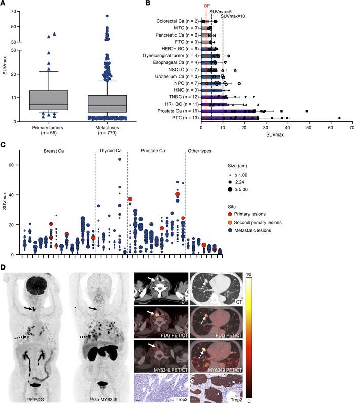 
68Ga-MY6349 uptake across various cancers.
(A) There were no significan...
