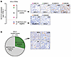 NOTCH1 signaling is active in SCLC.