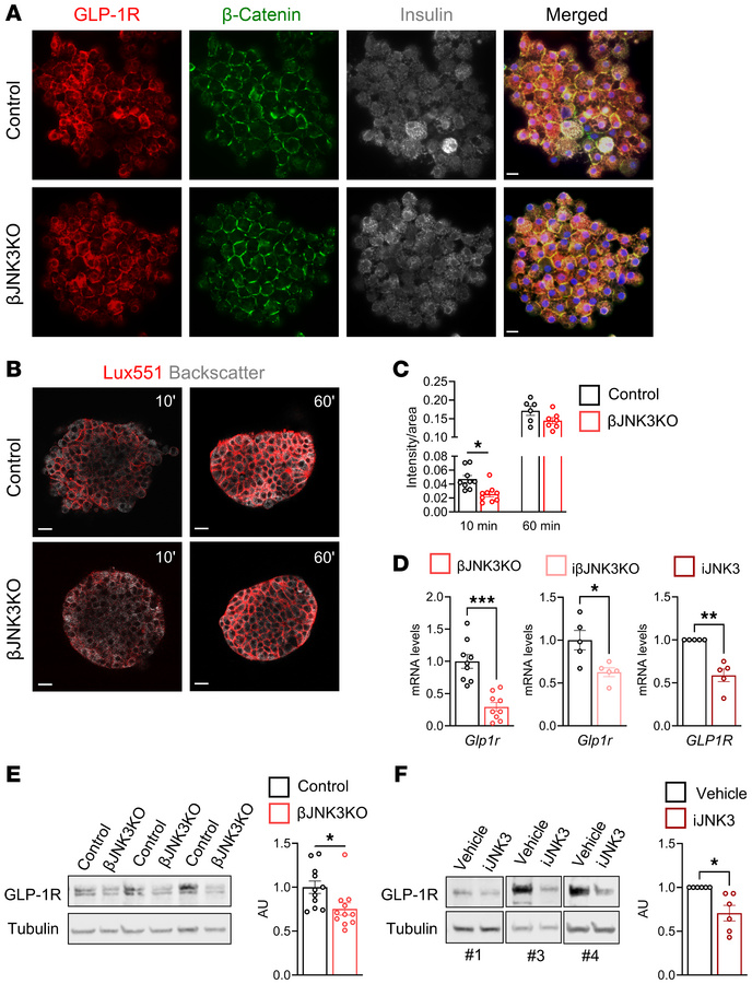 JNK3 inhibition reduces GLP-1R gene expression.
(A) Representative image...