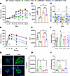 Beneficial effect of Ex4 in improving glucose homeostasis and preserving β