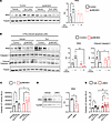 Protective effect of Ex4 against cytokine-induced apoptosis are mediated by
