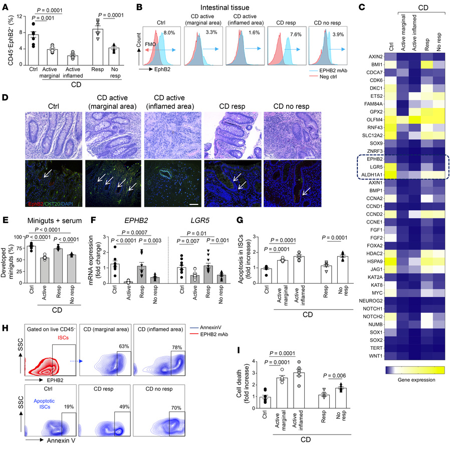 Intestinal stem cell defects exist in active Crohn’s disease.
(A and B)....