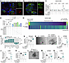 Mechanistic studies delineate a TMEM219-related proapoptotic downstream sig