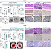Pharmacological blockade of IGFBP3/TMEM219 signal ameliorates DSS-mediated