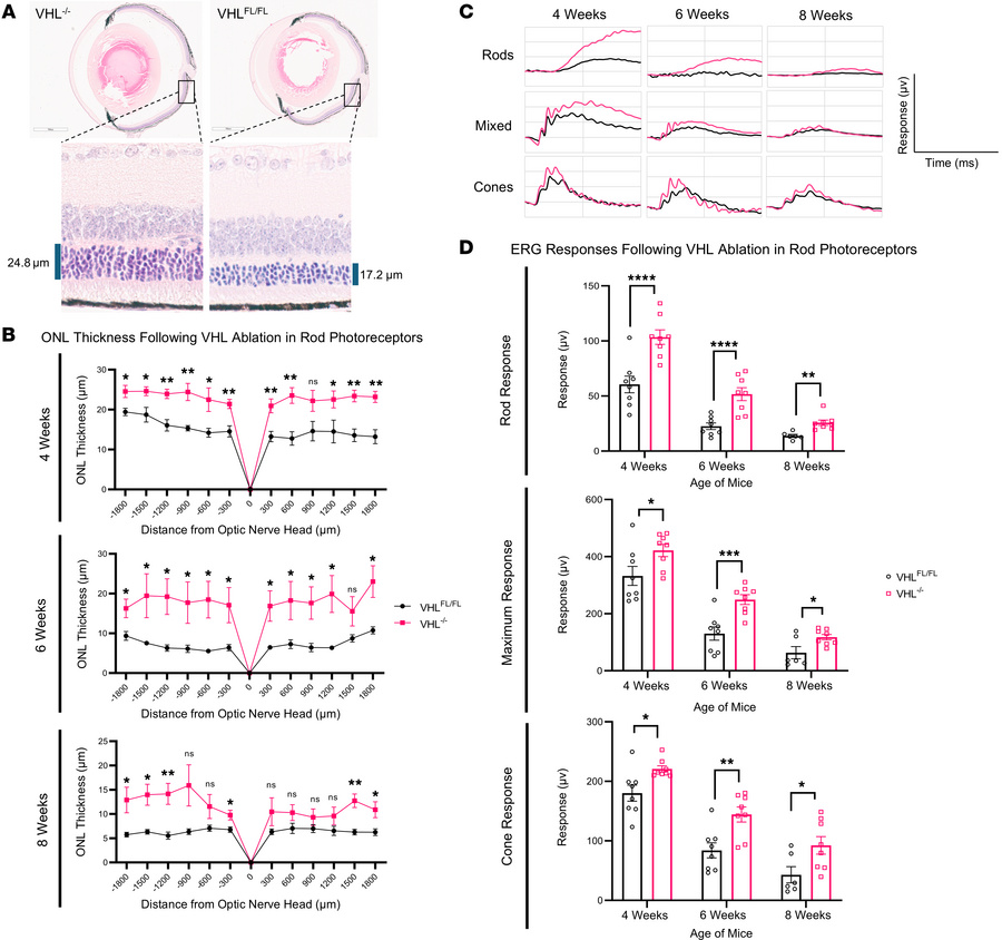 Rod-specific VHL ablation improves both rod and cone function in the Pde...