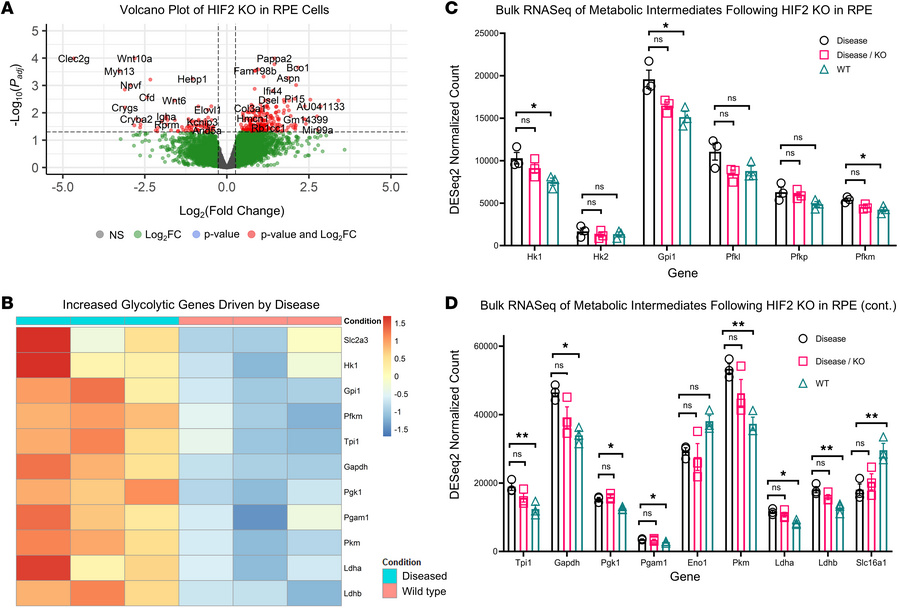 RPE-specific ablation of HIF2A does not alter metabolic transcriptome.
R...