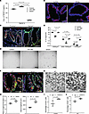 TNFSF13 variant colonoids/organoids exhibit enhanced colonoid formation eff